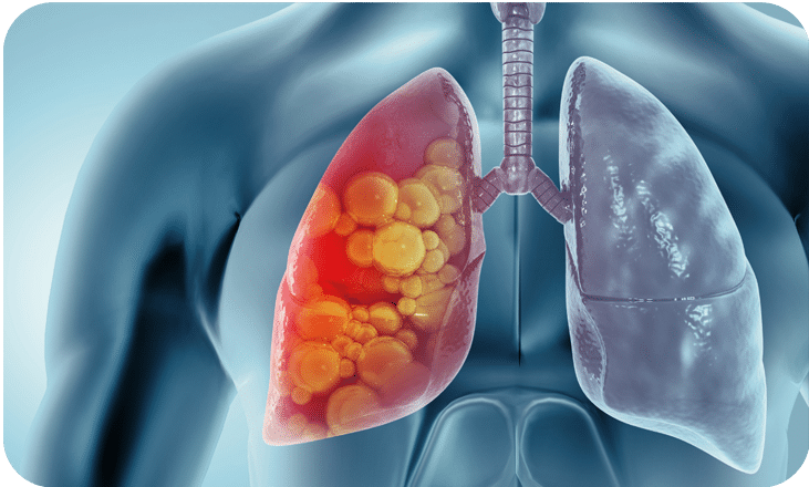 Thoracic Oncology Forum 2026 2027